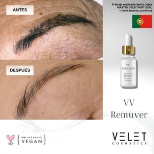 VV REMUVER – Image 5